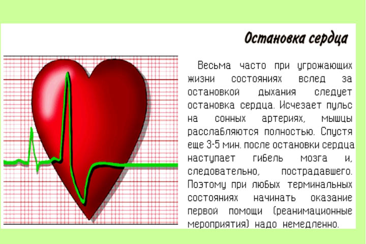 Названа частая причина остановки сердца
